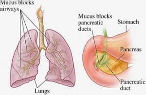 cystic fibrosis behandeling