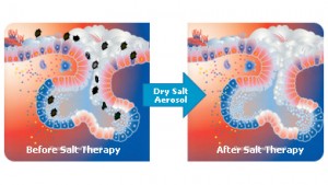 Halotherapie oftewel Zouttherapie helpt bij hooikoorts behandeling en Allergie behandeling in de zoutkamer Amsterdam, Zaandam en Heemstede.