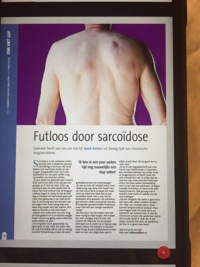 Futloos door sarcoïdose